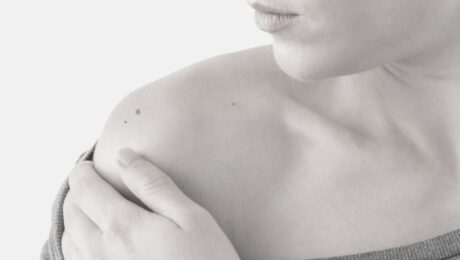 ben-aldirma-ameliyati-nedir