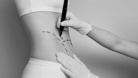 Rekonstrüktif Prosedürler nelerdir