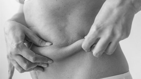 Mommy Makeover<div class='yasr-stars-title yasr-rater-stars-vv'
id='yasr-visitor-votes-readonly-rater-ee0a09e656b1a'
data-rating='0'
data-rater-starsize='16'
data-rater-postid='22334'
data-rater-readonly='true'
data-readonly-attribute='true'
data-cpt='posts'
></div><span class='yasr-stars-title-average'>0 (0)</span> Mommy Makeover