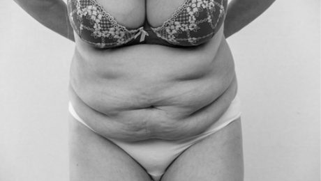 annelik estetiği ameliyatı nasıl yapılır<div class='yasr-stars-title yasr-rater-stars-vv'
id='yasr-visitor-votes-readonly-rater-09639e50ebaeb'
data-rating='0'
data-rater-starsize='16'
data-rater-postid='22350'
data-rater-readonly='true'
data-readonly-attribute='true'
data-cpt='posts'
></div><span class='yasr-stars-title-average'>0 (0)</span> annelik estetiği ameliyatı nasıl yapılır