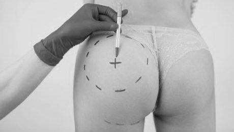 Popo büyütme ameliyatı sonrası enjekte edilen yağlar<div class='yasr-stars-title yasr-rater-stars-vv'
id='yasr-visitor-votes-readonly-rater-e5a0e9e80e0c6'
data-rating='0'
data-rater-starsize='16'
data-rater-postid='22285'
data-rater-readonly='true'
data-readonly-attribute='true'
data-cpt='posts'
></div><span class='yasr-stars-title-average'>0 (0)</span> Popo büyütme ameliyatı sonrası enjekte edilen yağlar