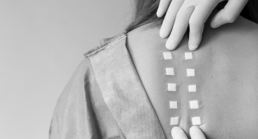 Sırt Germe Ameliyatı