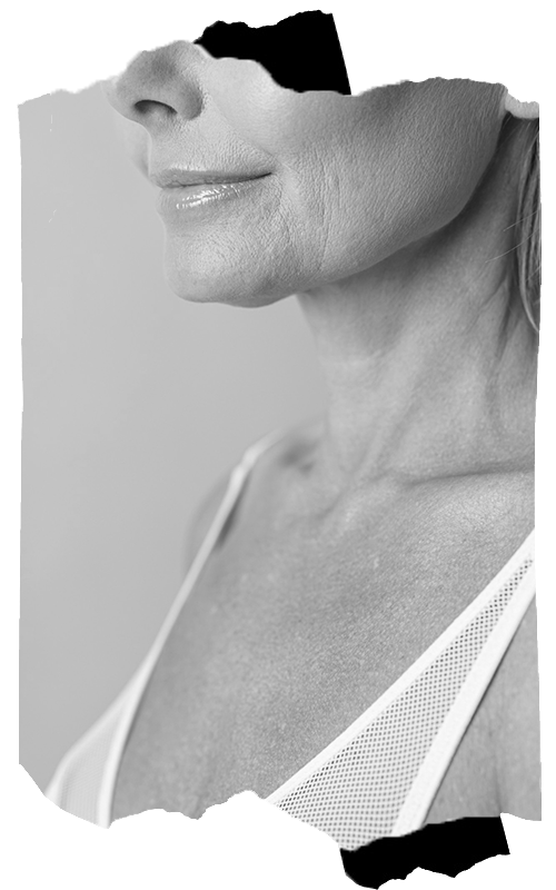 Ciltte Kollajen Kaybı ve Yaşlanma Ciltte Kollajen Kaybı ve Yaşlanma