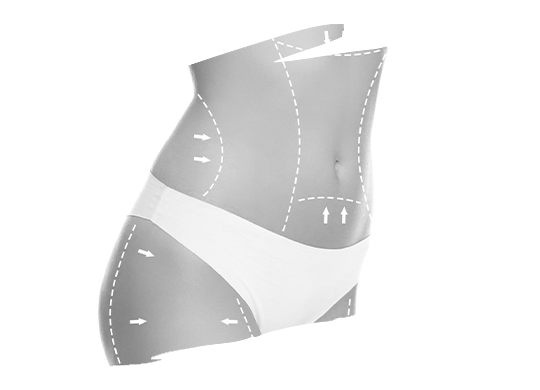 360 Bodylift Mikro Cerrahi